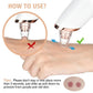 Blackhead Remover for Acne Prone Skin